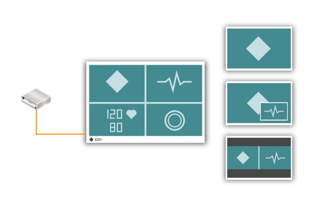 Accessory - TIP - all - Video Management