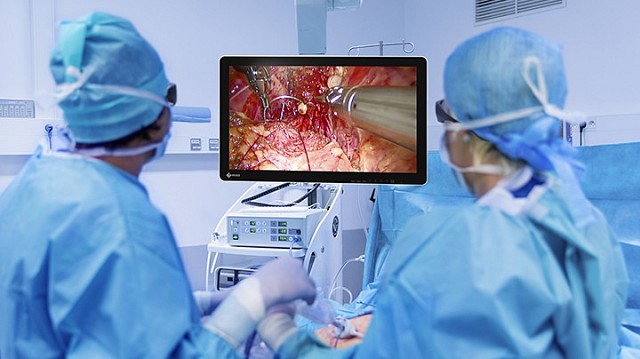 Monitor - Endo 3D - Visibilität 26"