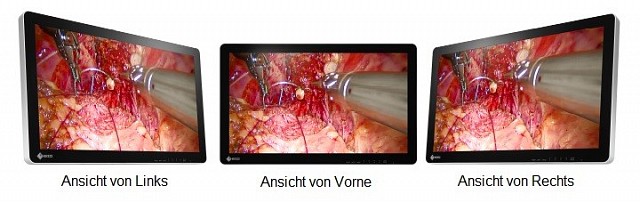 Monitor - Endo 3D - Betrachtungswinkel 26"
