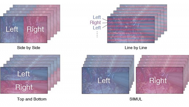 Monitor - Endo 3D - 3D-Formate