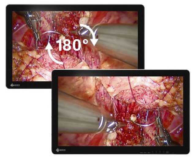 Monitor - Endo 3D - Rotation
