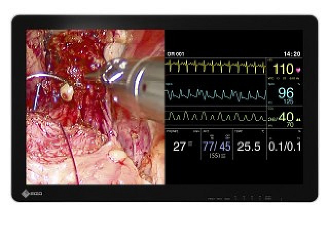 Monitor - Endo 3D - PbyP
