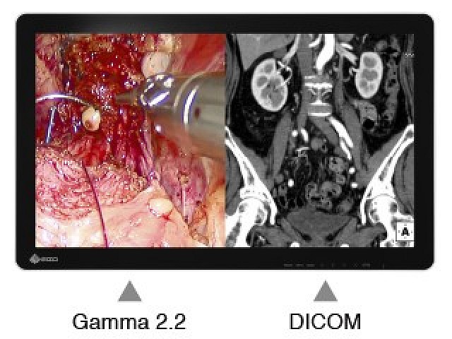 Monitor - Endo 3D - unabhängige Bildeinstellung