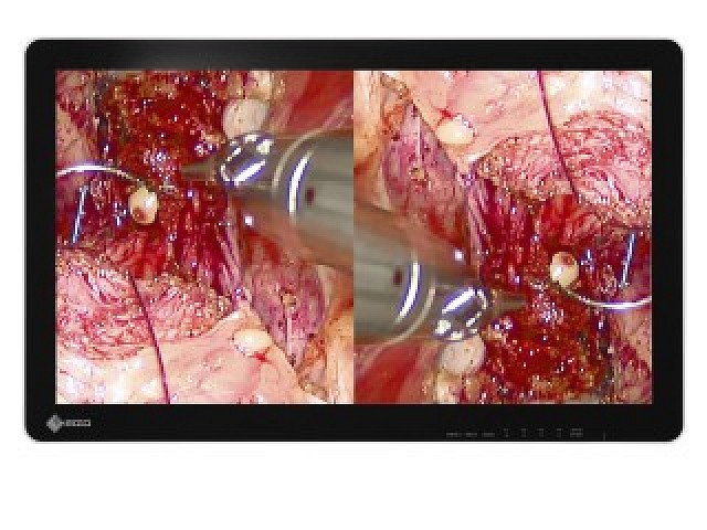 Monitor - Endo 3D - Rotation und Spiegelung