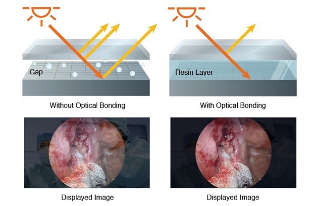 Monitor - Endo - Reduced Reflections