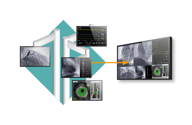 Monitor - Everything in a Single Glance