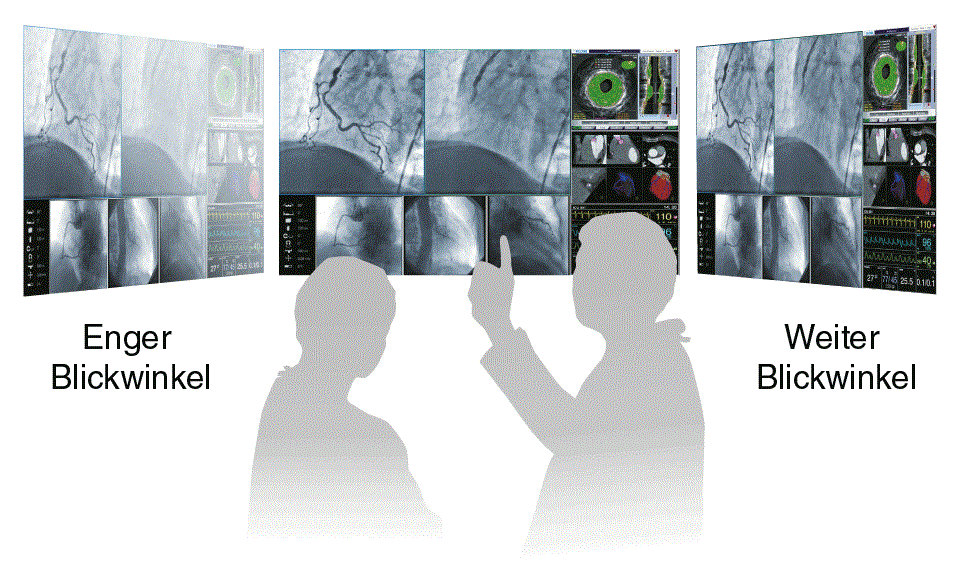 Monitor - Optimale Bildqualität aus jedem Betrachtungswinkel